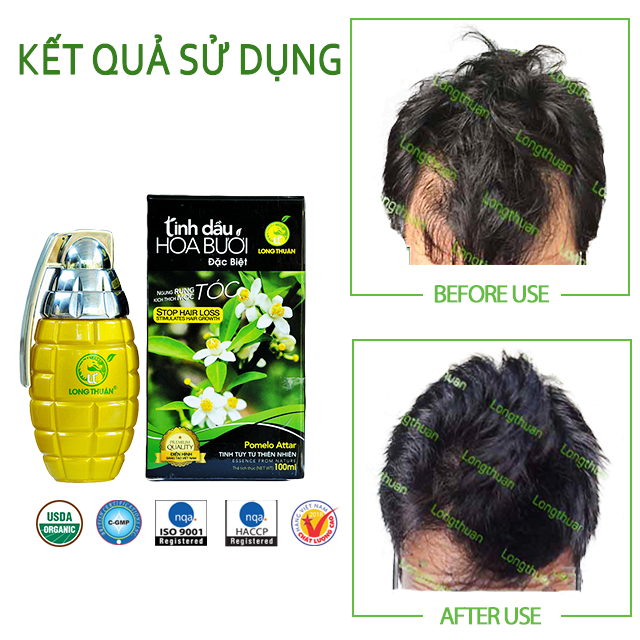 SAU KHI DÙNG TINH DẦU HOA BƯỞI, TÓC CÓ BỊ RỤNG LẠI HAY KHÔNG?