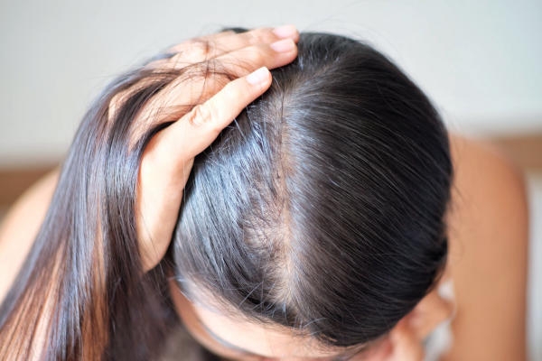 Tự Ti Vì Tóc Mỏng Muốn Thay Đổi Kiểu Tóc Cũng Khó
