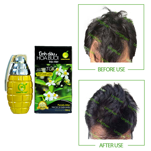 Fast Hair Growth Pomelo Flower Essential Oil Spray