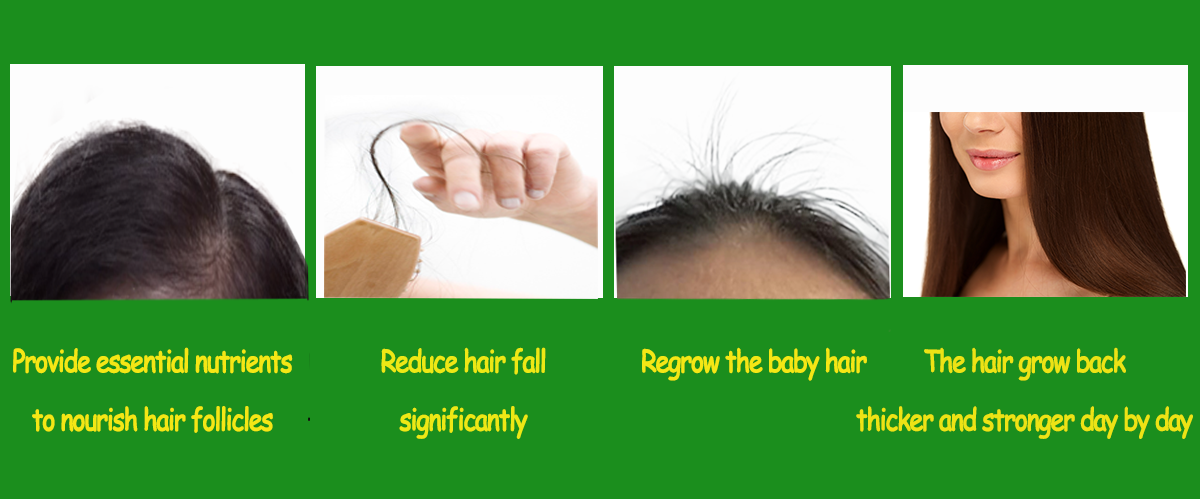 BEFORE - AFTER USING LONG THUAN'S HAIR GROWTH OIL SPRAY