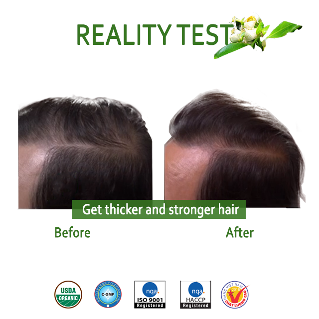 Fast Hair Growth Pomelo Flower Essential Oil Spray