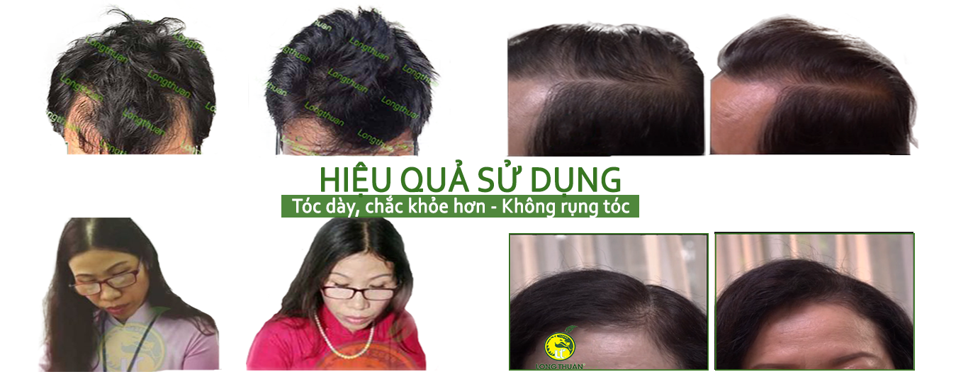 Hieu qua tinh dau moc toc long thuan